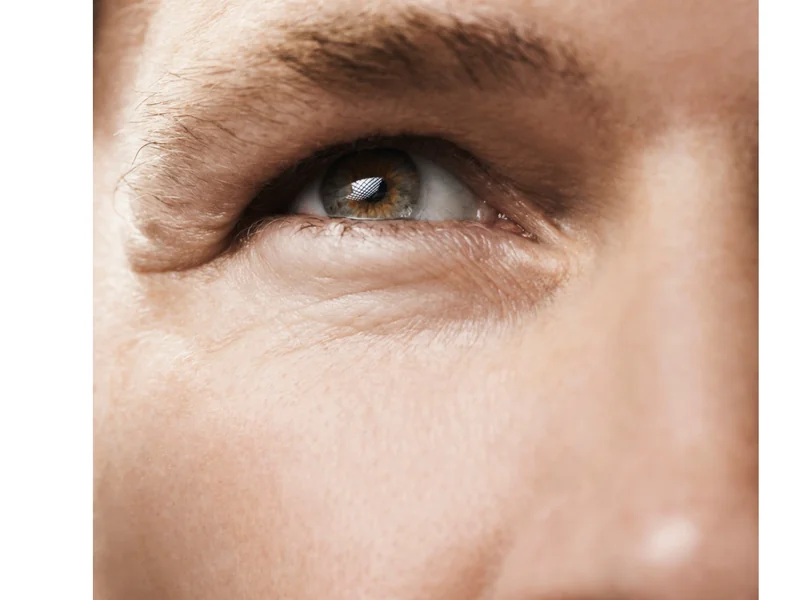 Zornesfalte glätten für Männer in München